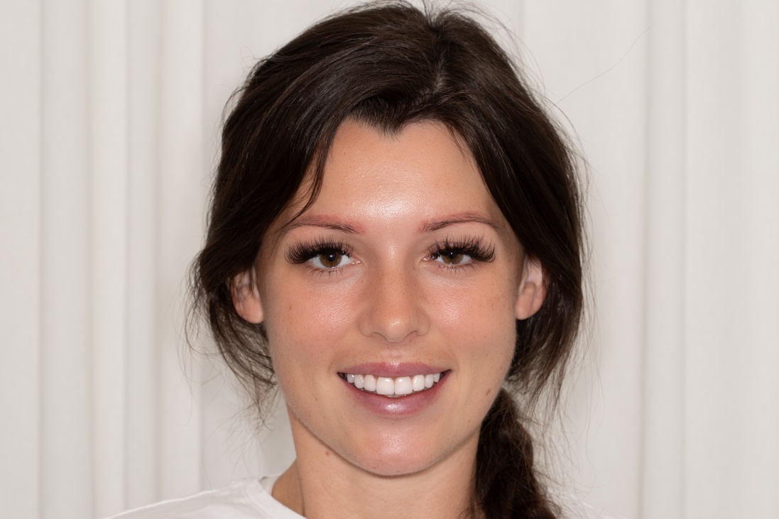  New Images Porcelain Veneers porcelain-veneers-newcastle-before-and-after-profilo-dental-16