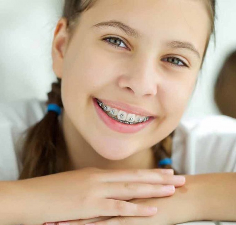 Images Blog First Ortho Exam Ceramic-braces-for-kids-teens-Newcastle-Sydney-Small